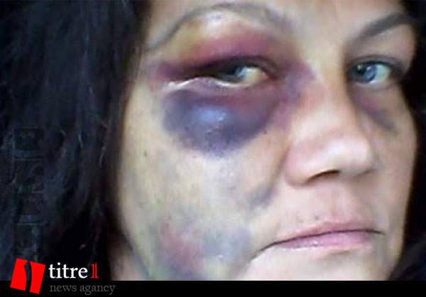 لحظه به لحظه با جنبش فرگوسن/ 6 ضربه مشت بر صورت زنی باردار توسط پلیس+تصاویر