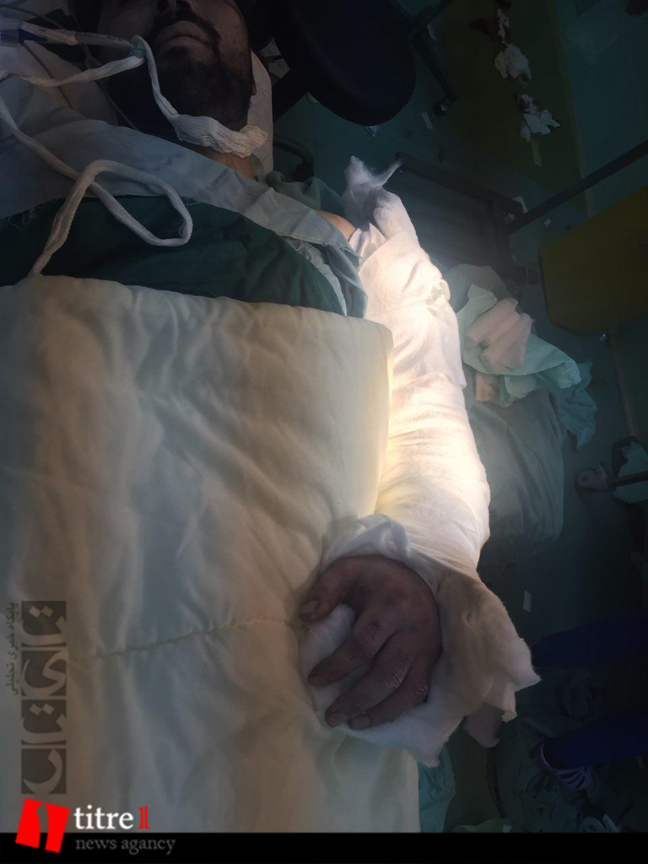 پیوند بازوی قطع شده جوان کارگر در بیمارستان کرج+ تصاویر+16