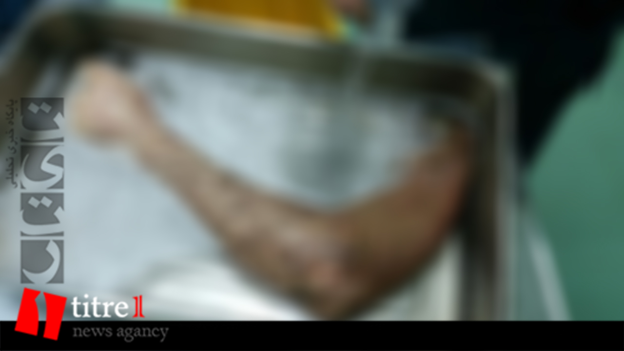 پیوند بازوی قطع شده جوان کارگر در بیمارستان کرج+ روایتی کامل از جزئیات خبر + تصاویر+16
