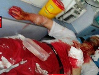 تصویر غرق در خون از روحانی آسیب‌دیده در حادثه امروز مترو شهرری