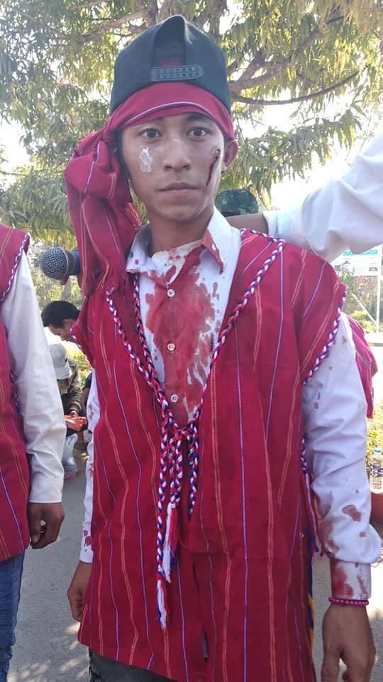 خشونت پلیس میانمار در برابر جوانان خواهان آزادی بیان در ایالت کارنی