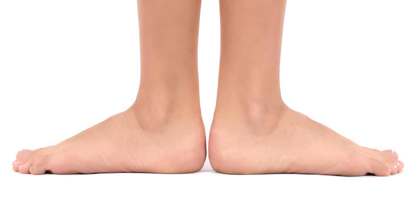 چگونه عارضه صافی کف پا را درمان کنیم؟