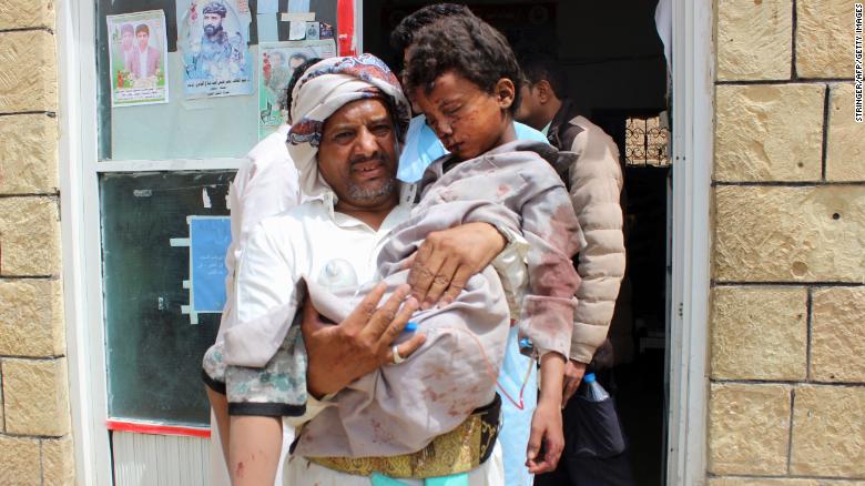 روایتی از جستجوی دردناک اجساد فرزندان توسط والدین یمنی/ یونیسف: حمله به دانش آموزان یمنی وحشیانه ترین حمله از 2015 بود