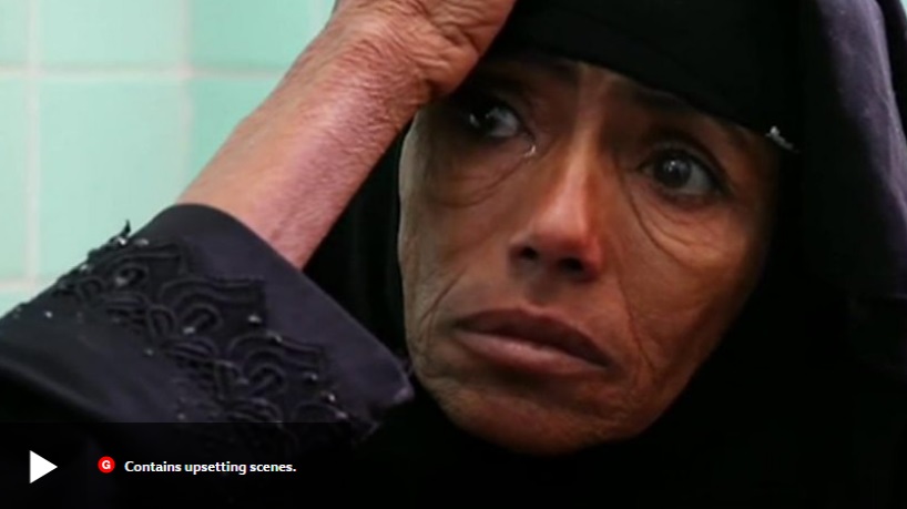 یمن، بدترین قحطی در 100 سال
