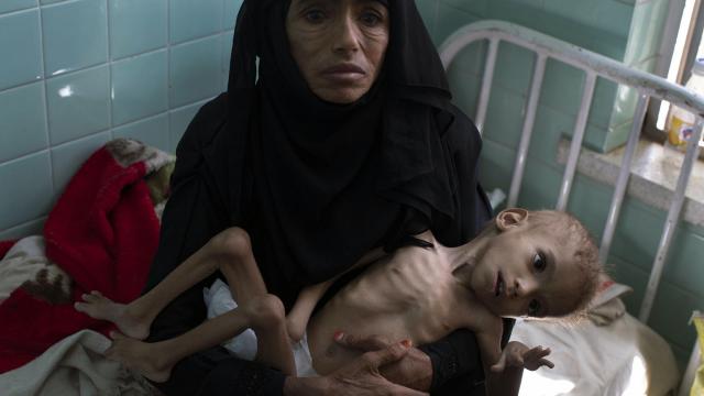 تراژدی جنگ عربستان سعودی در یمن