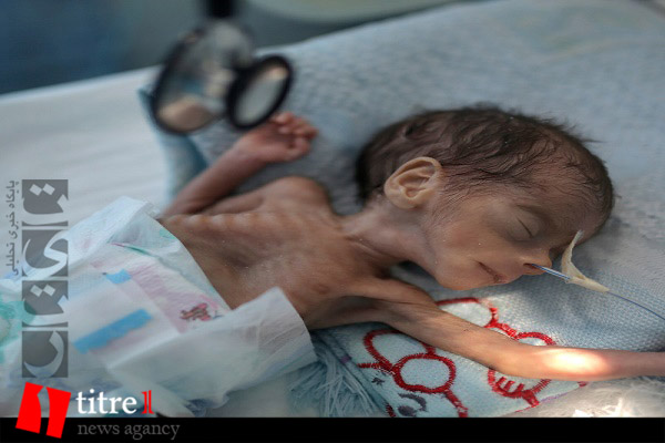 میلیون ها کودک یمنی در آستانه گرسنگی/ یمن بدترین مکان در جهان برای کودک بودن
