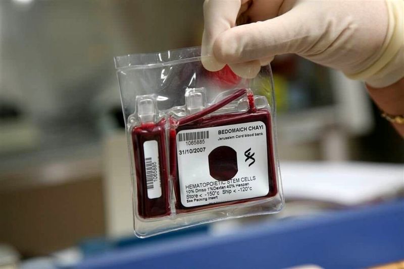 افزایش 20 درصدی ذخیره سلول های بنیادی خون بند ناف در البرز