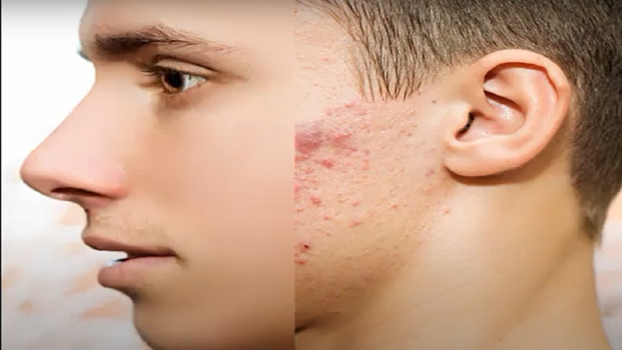 درمان لکه‌های پوستی با ۷ راهکار طلایی