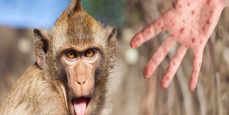 اولین مورد انتقال آبله میمون از انسان به حیوان شناسایی شد