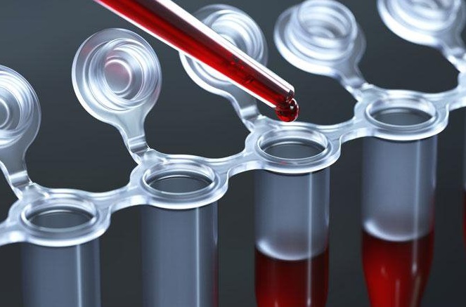 ابداع آزمایش خون جدید برای تشخیص سرطان‌ها